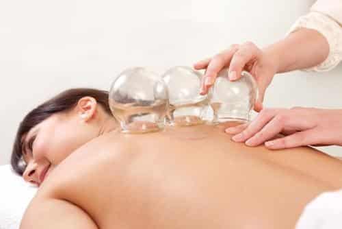 cupping | es-clinic.be, Health & Skin care